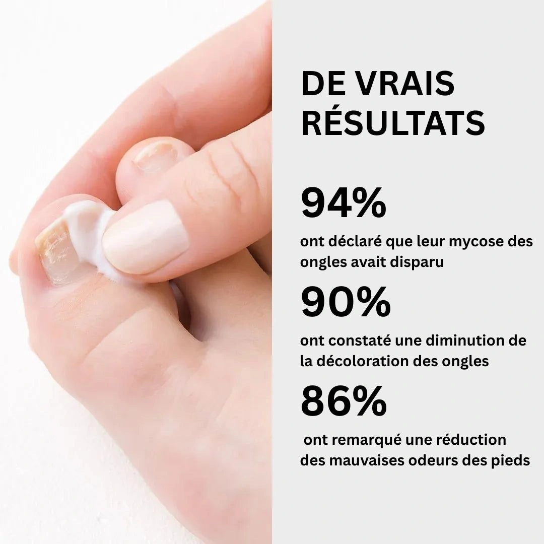 Gel contre les mycoses des ongles Ortholis